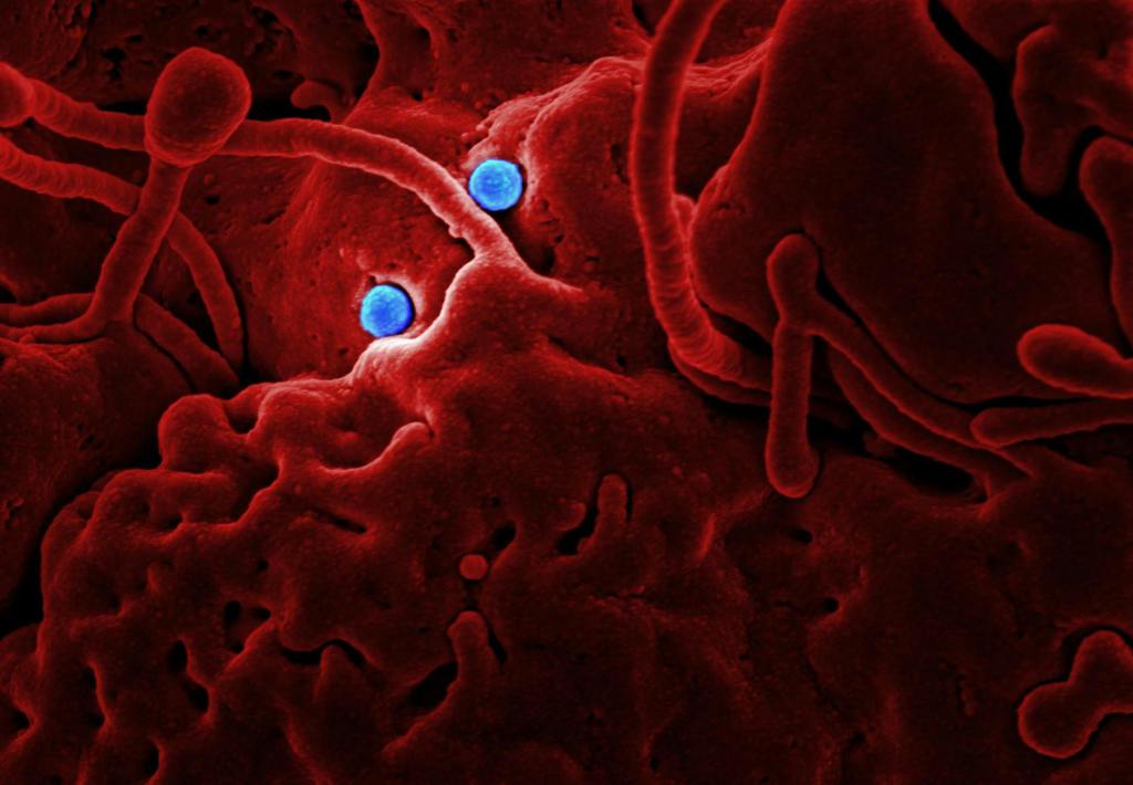 Health officials rule out Hantavirus cases in Philippines amid quarantine of cruise ship off&nbsp;Africa